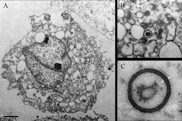 Three microscope images showing the cellular process of autophagy