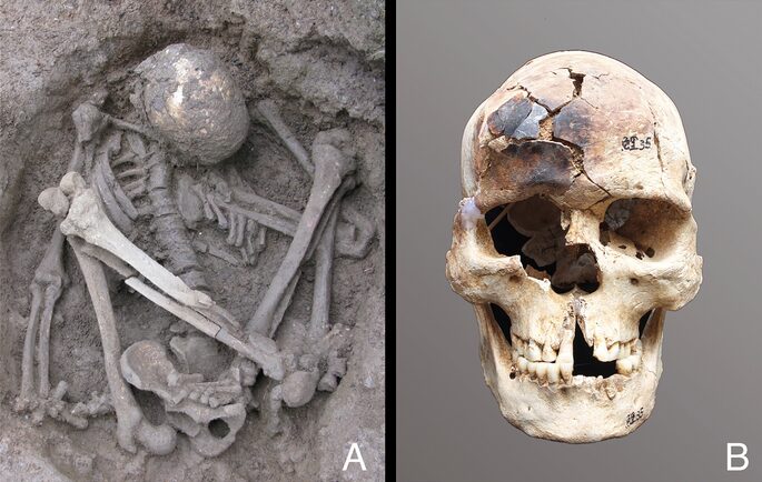 A crouched burial and burnt skull