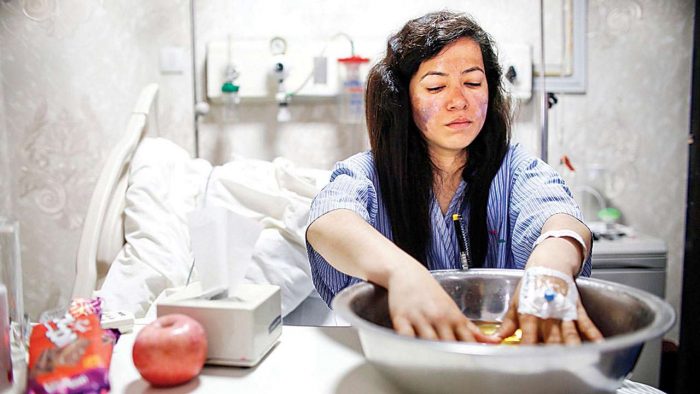 Chauhan in a hospital, hands submerged in water and iodine, her face showing frostnip.