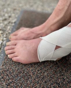 Bonhomme's injured foot.