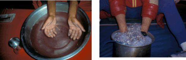 Hands in luke-warm water and in sapony water. 